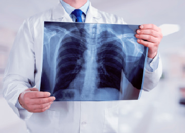 curso-de-auxiliar-radiologia